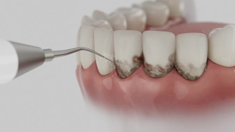 Reliable Tooth Extraction contractor in Clover, SC by Smile Center Dentistry